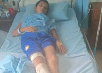 DIRAWAT. Iwan Fauzi (27), warga Blambanganpagar, saat dirawat di Rumah Sakit Imanuel, Bandar Lampung. (DOKUMENTASI LAMPUNG POST)