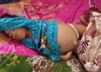 Laila hanya terbaring lemas karena menderita tumor perut. RIDWAN ANAS