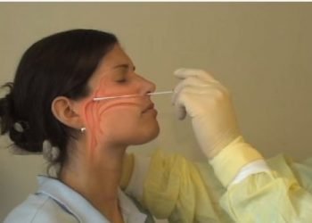 Tes Usap Cegah Klaster Penyelenggara Pilkada