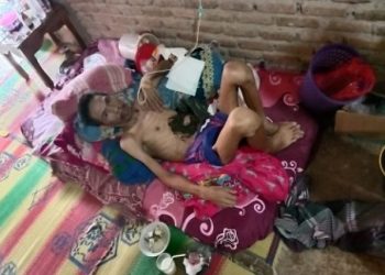 TERBARING LESU. Sarman Heriyadi (38), warga Dusun Susukan, Desa Sukaraja, Kecamatan Palas, Lampung Selatan, saat terbaring lesu menahan sakit tumor yang dideritanya, Senin (6/7). LAMPUNG POST/ARMANSYAH