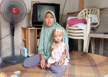 PANGKUAN IBU. Resta Nauri (22 bulan) pengidap hidrosefalus saat di pangkuan ibunya, Titin Handayani (31), di kediamannya di Dusun Karangmekar, Desa Mekarmulya, Kecamatan Palas, Lampung Selatan, Rabu (29/7). LAMPUNG POST/ARMANSYAH