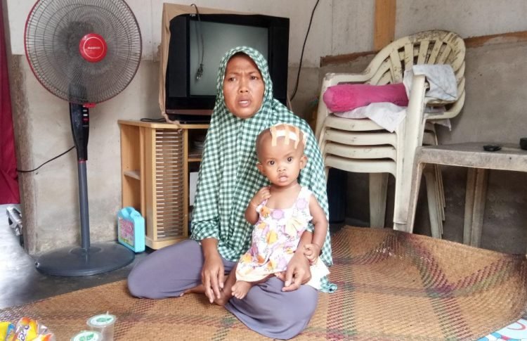 PANGKUAN IBU. Resta Nauri (22 bulan) pengidap hidrosefalus saat di pangkuan ibunya, Titin Handayani (31), di kediamannya di Dusun Karangmekar, Desa Mekarmulya, Kecamatan Palas, Lampung Selatan, Rabu (29/7). LAMPUNG POST/ARMANSYAH