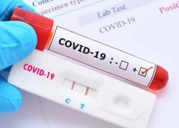 Alat uji tes Covid-19 harus tersedia. (DOK)