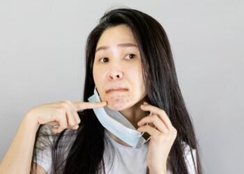 Wanita muda Asia mengenakan masker wajah medis dan kaos putih, tangannya menunjuk ke jerawat di dagu, Alergi kulit karena memakai masker. (DOK.ALADOKTER)