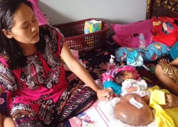pengobatan bayi