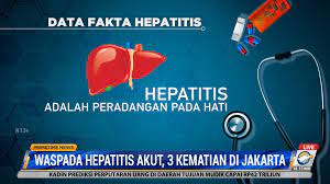 Hepatitis akut. (MI)