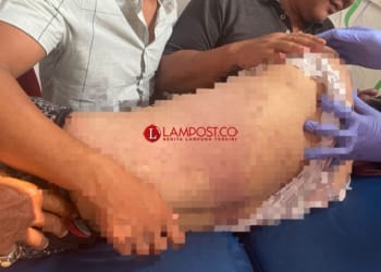 Polres Pesisir Barat Ambil Alih Kasus Kematian A Rozak