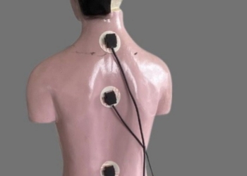 Mahasiswa Itera Kembangkan Alat Pendeteksi Kelainan Tulang Belakang