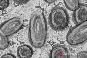 WHO Setujui Uji Diagnostik Mpox Pertama untuk Penggunaan Darurat