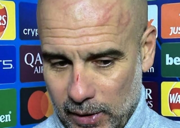 Pep Guardiola luka - luka usai laga Manchester City vs Feyenoord.