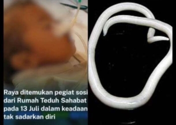 Waspada! Ini Penyebab Cacingan Pada Anak
