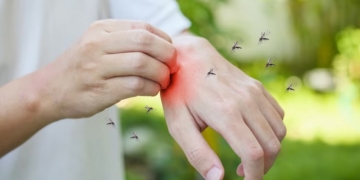 Itera Jajaki Kerja Sama dengan Dinkes Lampung soal Penanganan Malaria   